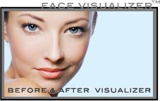 Face Visualizer | Pender Medi Spa Vancouver