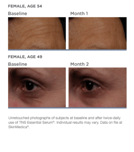 B&A Pender Feb Special